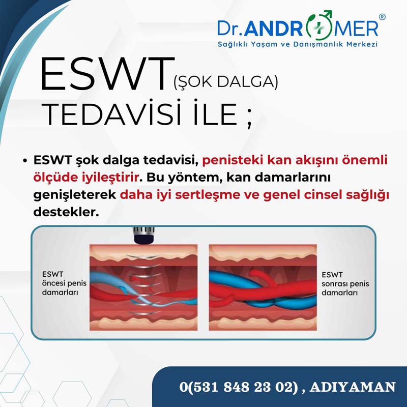 Adıyaman ESWT Tedavi Merkezi