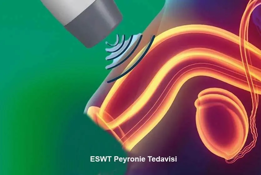 ESWT-peyronie-tedavi-adıyaman